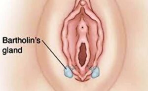 bartholin's gland